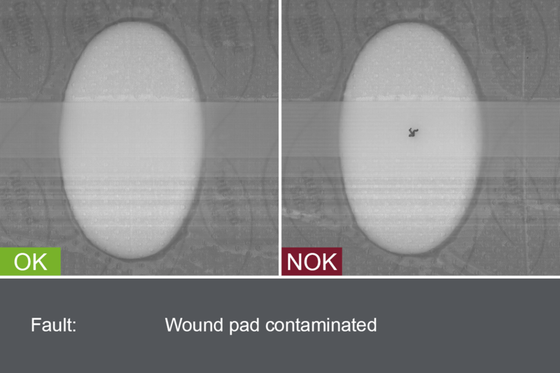 Inspection for wound pad contamination (variant 2)
